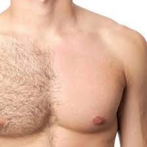 Laser Hair Removal – Chest – Men