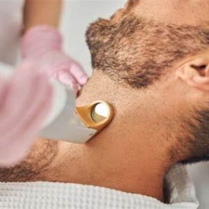 Laser Hair Removal – Beard line (up and down)