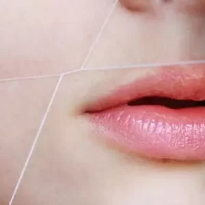 Threading-Upper-Lip